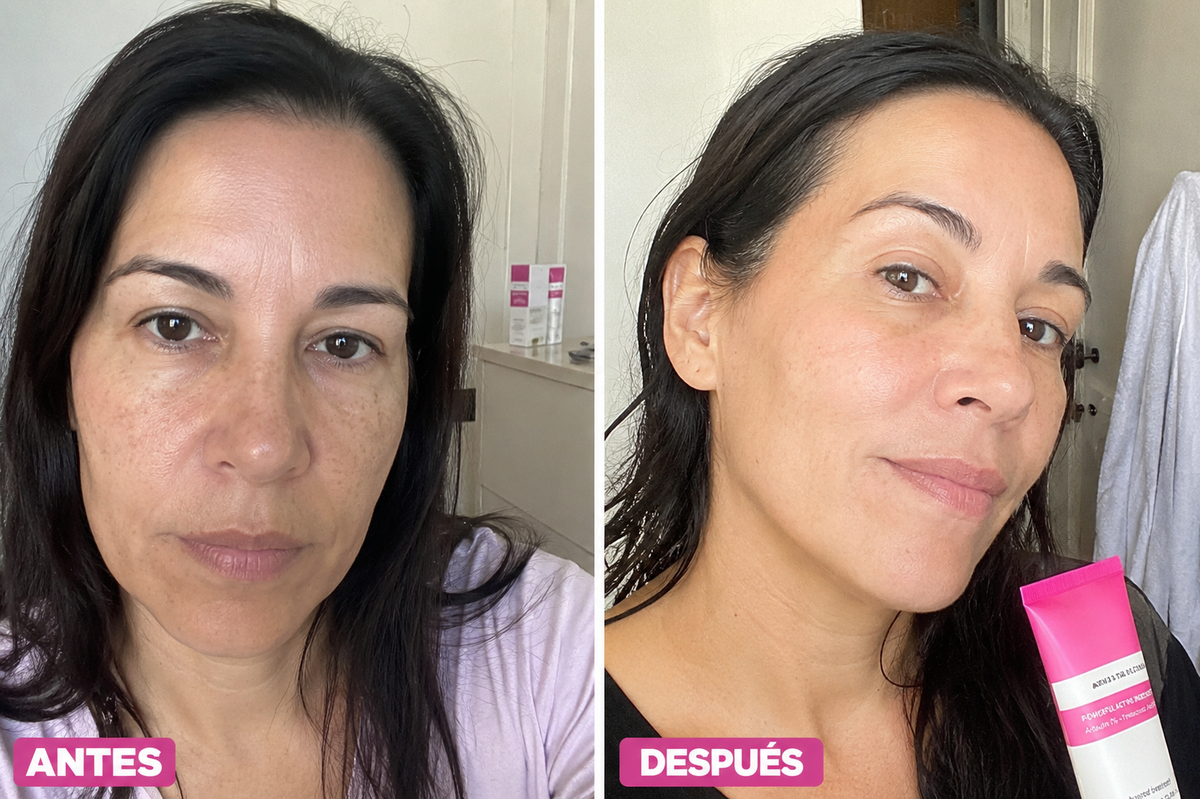 Verdana Crema Anti Manchas Con Arbutina